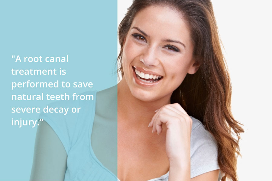 Featured image for “Root Canal 101: When to Opt for This Essential Treatment”