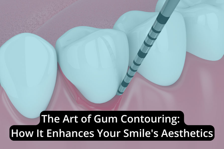 Featured image for “The Art of Gum Contouring: How It Enhances Your Smile’s Aesthetics”